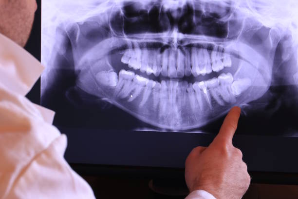 Best Emergency Root Canal Treatment in Conover, NC