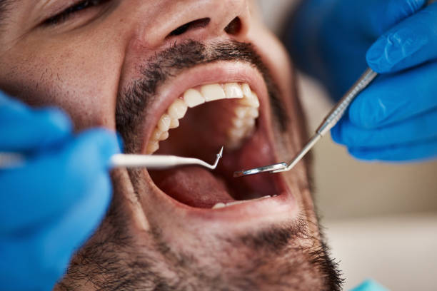 Best Emergency Dentist for Knocked-Out Tooth in Conover, NC