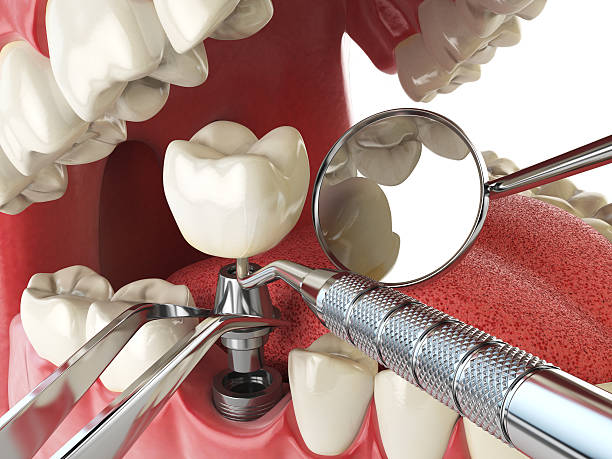 Best Emergency Dental Services for Seniors in Conover, NC